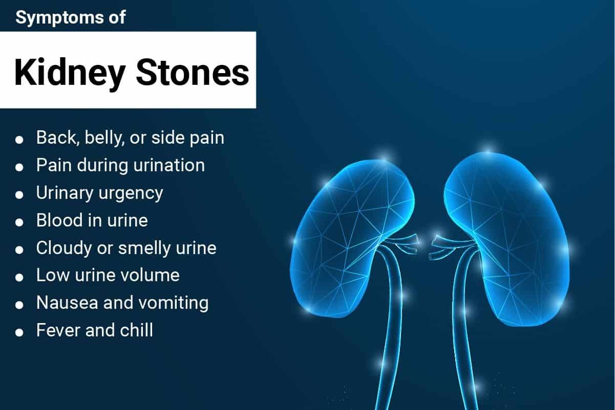 Kidney Stones: Relief In 5 Easy Steps Without Operations