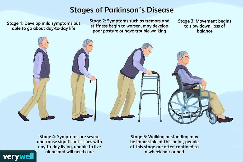 parkinson's